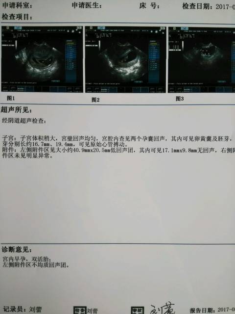 做供卵试管婴儿有5大流程，想生孩子的不孕不育姐妹们要注意收集