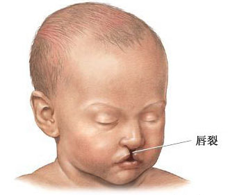 第二代供卵试管婴儿的成功率高吗？(1)