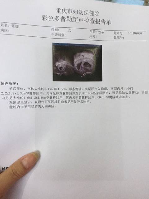 赠卵试管婴儿取卵后，我的月经会提前或推迟吗？