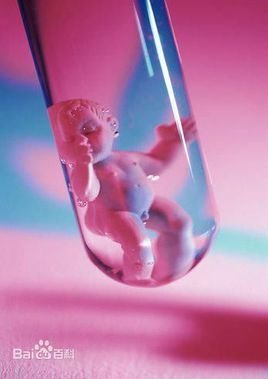 借卵供卵代怀代生移植成功后可以进行胎儿流产吗？预防胎儿流产的