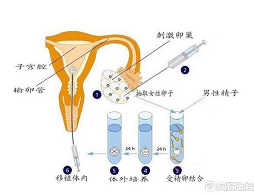 有在徐州四院供卵试管的吗成功率高不高