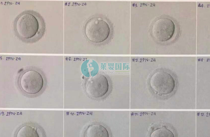 借卵做试管促排几个卵合适
