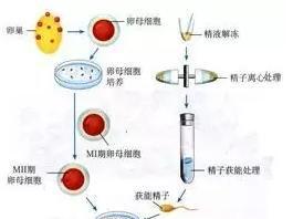 做借卵试管婴儿经期前检查还是经期后检查