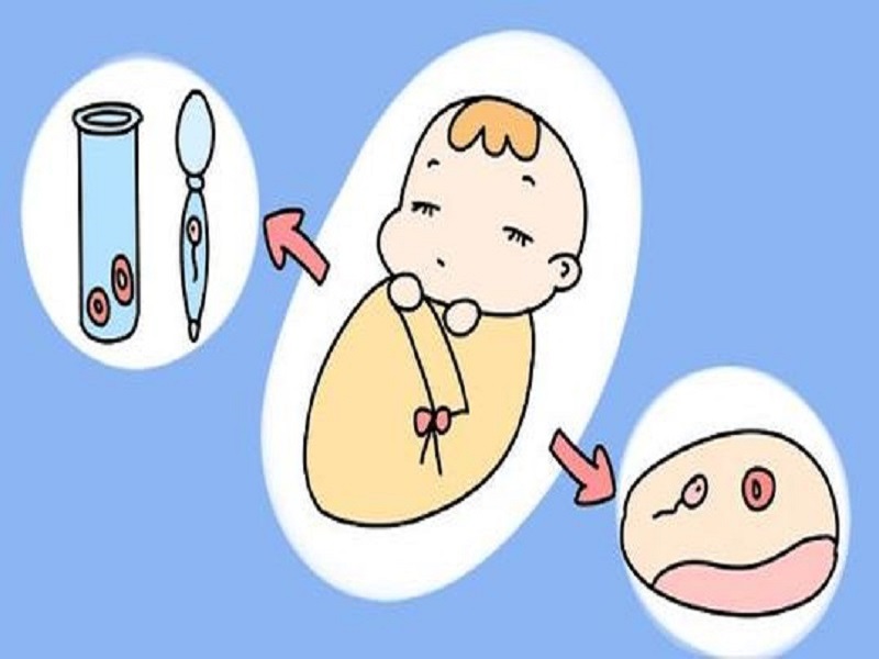 北医三院做借卵试管