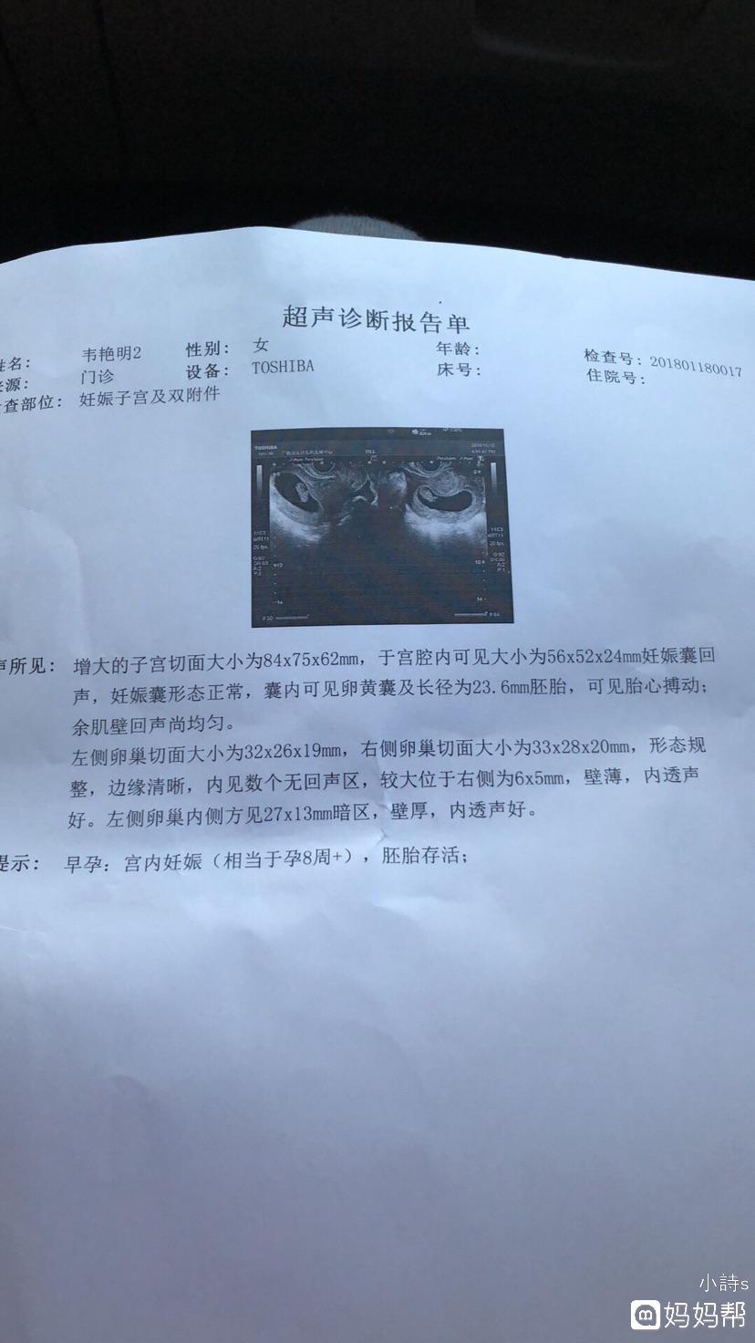广州第三代借卵试管婴儿医院哪家好
