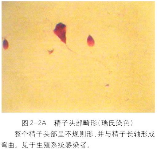 广州哪个医院赠卵试管成功率高