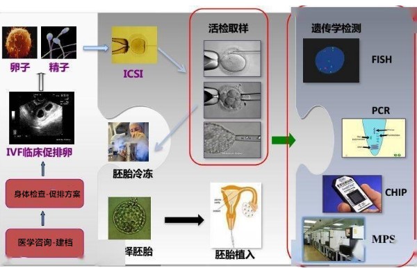 孕宝国际试管婴儿