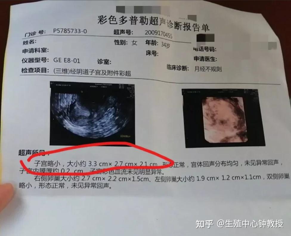 打胎和试管哪个危害大