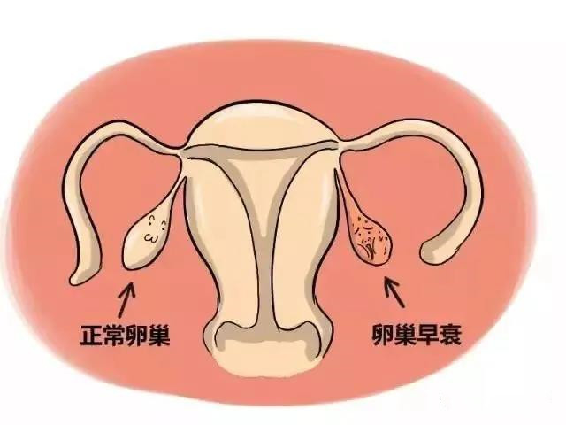 染色体正常试管成功率高吗
