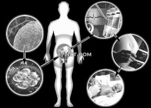 广州省哪个医院做试管成功率高？