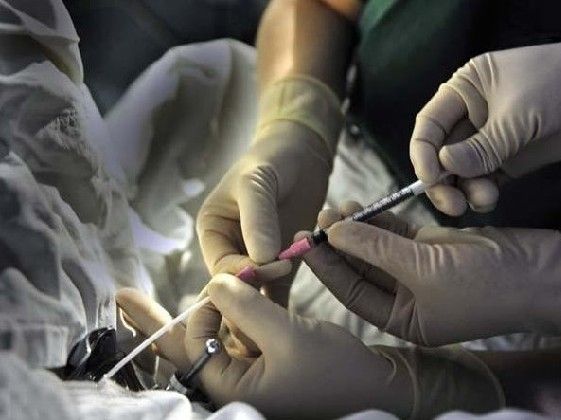 广州省哪个医院做试管成功率高？