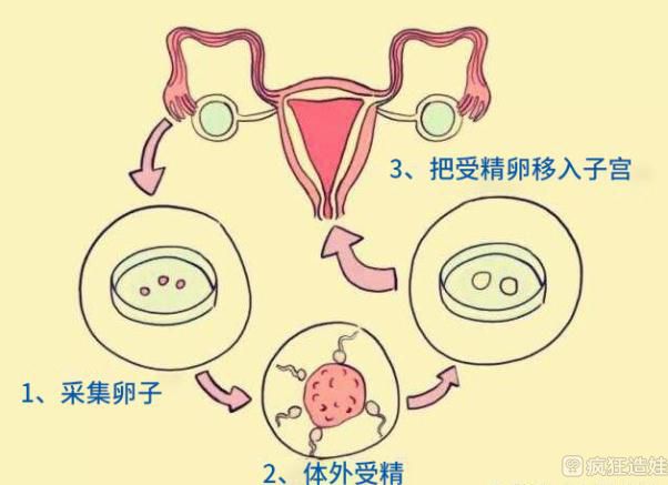 代生孩子价格停胎胚胎原因_注意,导致请人试管代怀是否违法胚胎不发育或停育的7个原因!