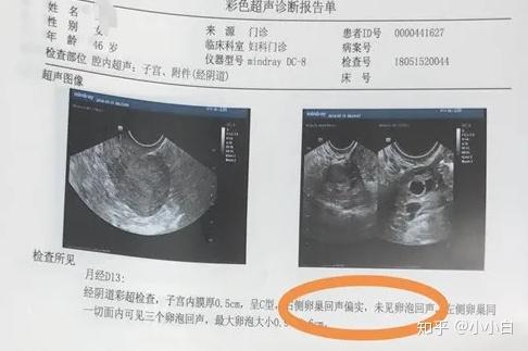 我想找人试管代怀身体检查哪些_做试管要检查身体的哪些方面？