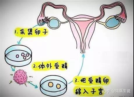 广州想找个试管代怀妈妈咨询(爱的助孕)