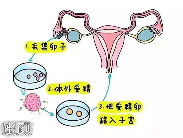 广州做个试管代怀的优缺点分析要多少钱+附2024广州借卵试管代怀服务成功率前四医院名单