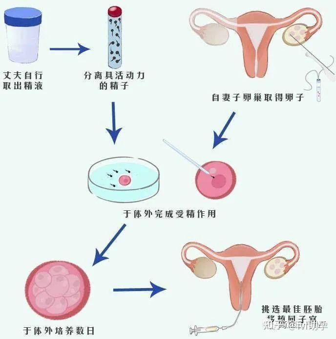 广州代怀男孩费用怎么样,安全有没有保障