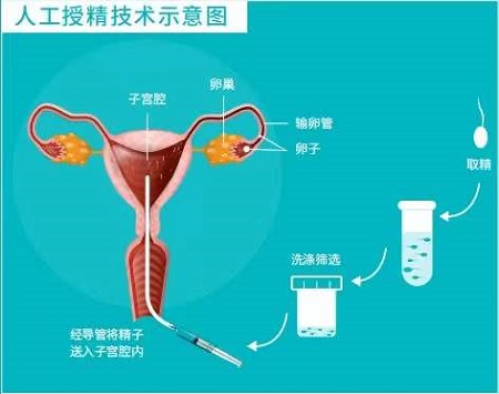 2024广州供卵代生医院医院排名