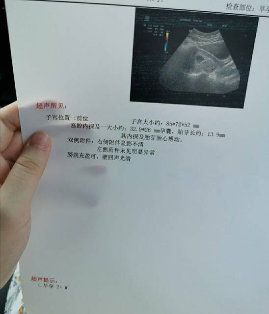 我想去做试管代怀双胞胎男多少钱