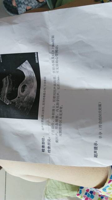 人工授精对精子有何要求+人工授精有什么要求