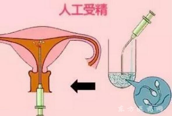 2024广州和睦家医院代生代怀公司哪家正规婴儿生双胞胎费用多少（准备15万够吗）