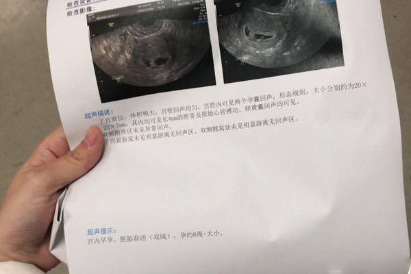 2024广州市弓形子宫有哪些试管代怀公司婴儿的医院有哪些（附广州弓形子宫试管医院前五排名）