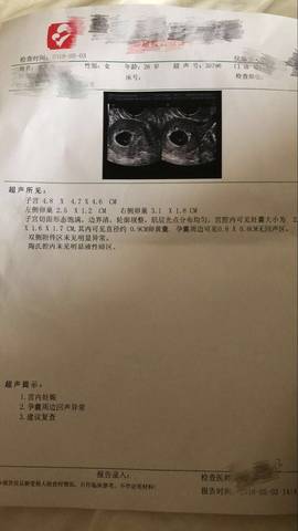 广州市妇女儿童中心医院第二代国内代生全流程