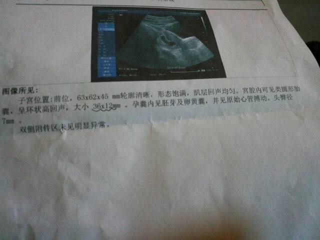广州市妇女儿童中心医院第二代国内代生全流程
