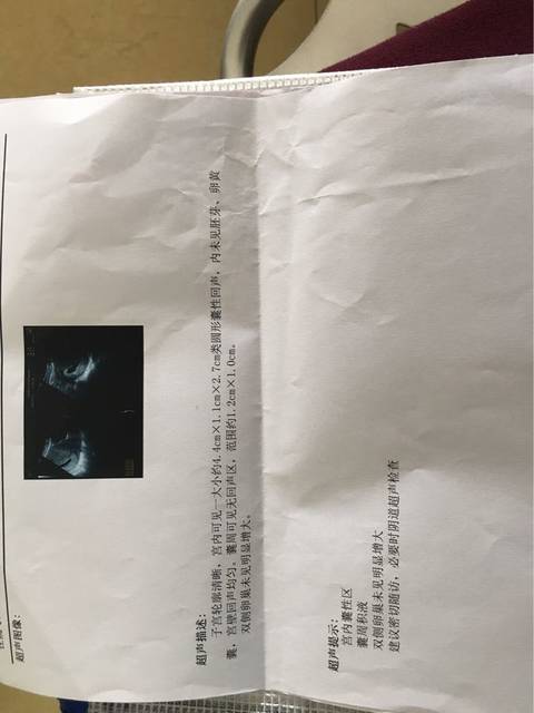 促排卵了三次失败还要继续（过来人建议先做好这三件事）