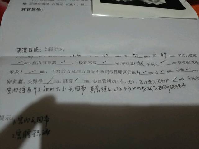 促排卵了三次失败还要继续（过来人建议先做好这三件事）