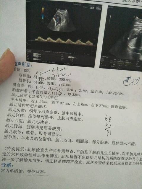 广州正规的代怀联系方式哪几家比较好