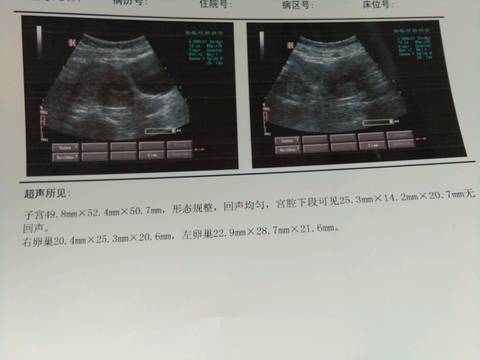 试管有胚胎第二次移植要多少钱