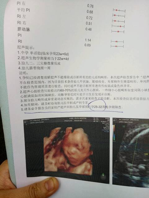 网传100%生女儿的症状盘点,怀女宝的征兆有多少可准了